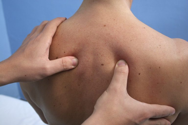Therapeutic rehabilitation massage package to aid recovery and alleviate pain at Ria’s Touch Massage in Shelby Township, MI.